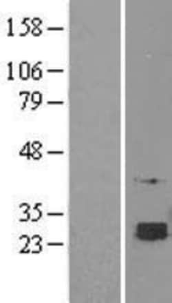 Novus Biologicals&trade;&nbsp;SELT Overexpression Lysate