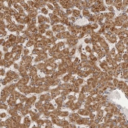 Semaphorin 3A Antibody, Novus Biologicals 25 &mu;L; Unlabeled:Antibodies,