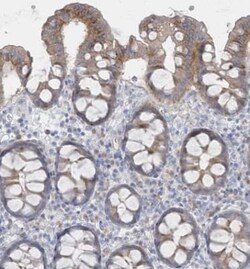 SEMA3D Antibody, Novus Biologicals:Antibodies:Primary Antibodies