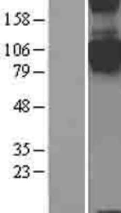 Novus Biologicals&trade;&nbsp;Semaphorin 4C Overexpression Lysate