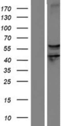 Novus Biologicals&trade;&nbsp;Semaphorin 6D Overexpression Lysate