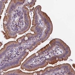 Semaphorin 7A Antibody, Novus Biologicals 0.1mL; Unlabeled:Antibodies,