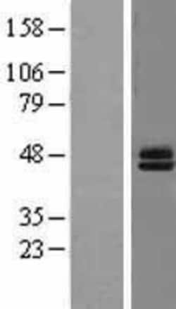 Novus Biologicals&trade;&nbsp;Semenogelin I Overexpression Lysate