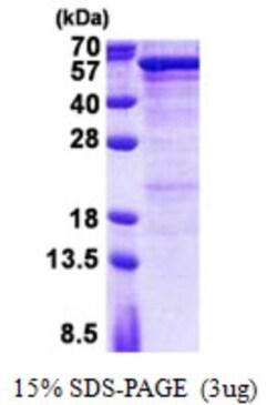 Novus Biologicals&trade;&nbsp;Recombinant Human Semenogelin I His Protein