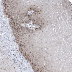 sen15 Antibody, Novus Biologicals 0.1mL; Unlabeled:Antibodies, Polyclonal