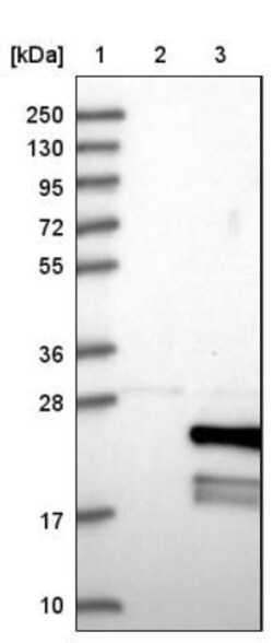 sen15 Antibody, Novus Biologicals 0.1mL; Unlabeled:Antibodies, Polyclonal