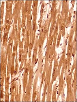 Senataxin Antibody - BSA Free, Novus Biologicals 0.025mL; Unlabeled:Antibodies,