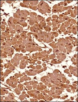Senataxin Antibody - BSA Free, Novus Biologicals 0.025mL; Unlabeled:Antibodies,