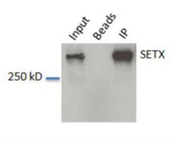 Senataxin Antibody - BSA Free, Novus Biologicals 0.025mL; Unlabeled:Antibodies,