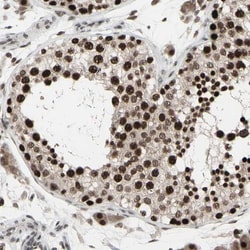 SENP1 Antibody, Novus Biologicals 0.1mL; Unlabeled:Antibodies, Polyclonal
