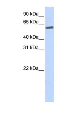 SENP3 Antibody, Novus Biologicals 20&mu;L; Unlabeled:Antibodies, Polyclonal