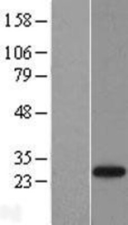 Novus Biologicals™ NEDP1/SENP8 Overexpression Lysate