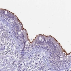 Sentan Antibody, Novus Biologicals 25 &mu;L, Unlabeled:Antibodies, Polyclonal