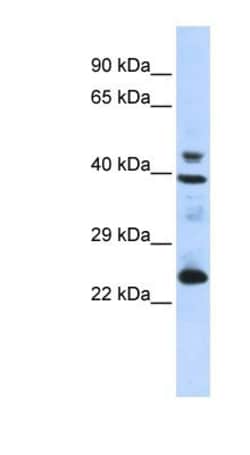 SeP Antibody, Novus Biologicals 100&mu;L; Unlabeled:Antibodies, Polyclonal