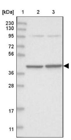 SEPHS1 Antibody, Novus Biologicals 25 &mu;L; Unlabeled:Antibodies, Polyclonal