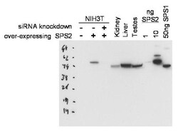 SEPHS2 Antibody, Novus Biologicals 0.1mg; Unlabeled:Antibodies, Polyclonal