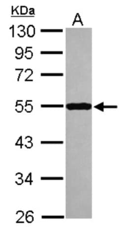 Septin-10 Antibody, Novus Biologicals 0.1mL; Unlabeled:Antibodies, Polyclonal