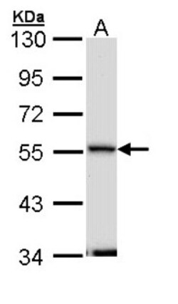 Septin-11 Antibody, Novus Biologicals 0.1mL; Unlabeled:Antibodies, Polyclonal