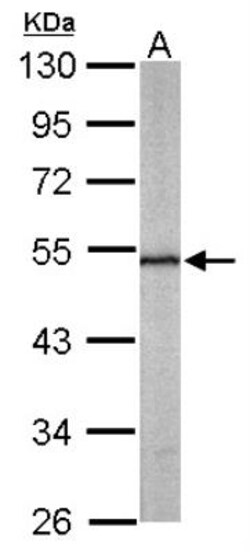 Septin-11 Antibody, Novus Biologicals 0.1mL; Unlabeled:Antibodies, Polyclonal