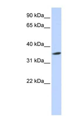 Septin-12 Antibody, Novus Biologicals 100&mu;L; Unlabeled:Antibodies, Polyclonal