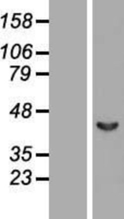 Novus Biologicals&trade;&nbsp;Septin-2 Overexpression Lysate