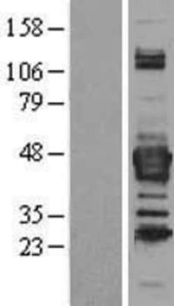 Novus Biologicals&trade;&nbsp;Septin-3 Overexpression Lysate