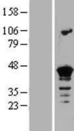 Novus Biologicals&trade;&nbsp;Septin-3 Overexpression Lysate