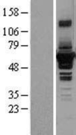 Novus Biologicals&trade;&nbsp;Septin-4 Overexpression Lysate