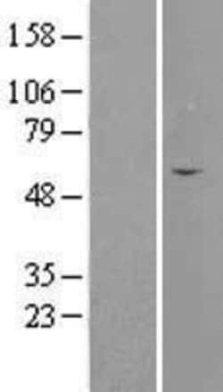 Novus Biologicals&trade;&nbsp;Septin-4 Overexpression Lysate
