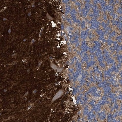 Septin-4 Antibody, Novus Biologicals 25 &mu;L; Unlabeled:Antibodies, Polyclonal