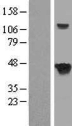 Novus Biologicals™ Septin-5 Overexpression Lysate