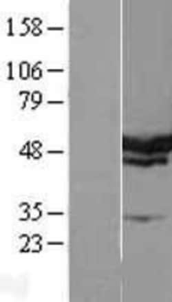 Novus Biologicals&trade;&nbsp;SERBP1 Overexpression Lysate