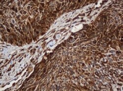 SERBP1 Antibody (OTI5G2), Novus Biologicals 0.1mL; Unlabeled:Antibodies,