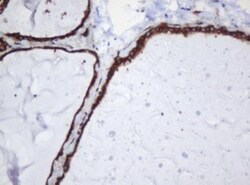SERBP1 Antibody (OTI5G2), Novus Biologicals 0.1mL; Unlabeled:Antibodies,