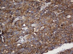 SERBP1 Antibody (OTI5G2), Novus Biologicals 0.1mL; Unlabeled:Antibodies,