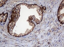 SERBP1 Antibody (OTI5G2), Novus Biologicals 0.1mL; Unlabeled:Antibodies,