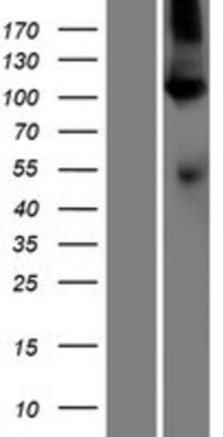 Novus Biologicals&trade;&nbsp;SERCA1 ATPase Overexpression Lysate