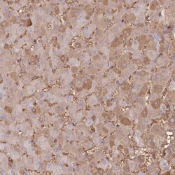 SERINC1 Antibody, Novus Biologicals 0.1mL; Unlabeled:Antibodies, Polyclonal