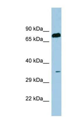 Serine Dehydratase Antibody, Novus Biologicals:Antibodies:Primary Antibodies