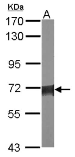 Serine Palmitoyltransferase 2 Antibody, Novus Biologicals 0.1 mL | Buy Online | Novus Biologicals | Fisher Scientific