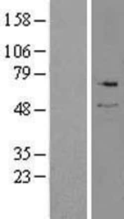 Novus Biologicals&trade;&nbsp;Serine Palmitoyltransferase 2 Overexpression Lysate