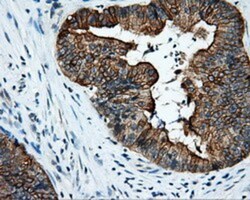 Serine racemase Antibody (OTI2E3), Novus Biologicals 0.1mL; Unlabeled:Antibodies,