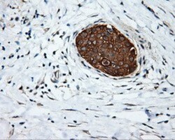 Serine racemase Antibody (OTI2E3), Novus Biologicals 0.1mL; Unlabeled:Antibodies,