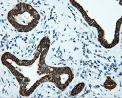 Serine racemase Antibody (OTI2E3), Novus Biologicals 0.1mL; Unlabeled:Antibodies,