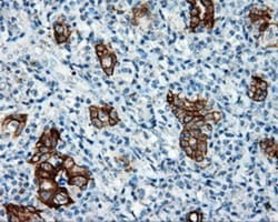 Serine racemase Antibody (OTI2E3), Novus Biologicals 0.1mL; Unlabeled:Antibodies,