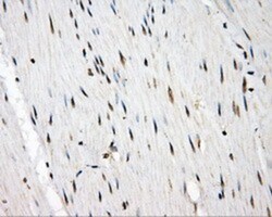 Serine racemase Antibody (OTI2E3), Novus Biologicals 0.1mL; Unlabeled:Antibodies,