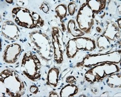 Serine racemase Antibody (OTI2E3), Novus Biologicals 0.1mL; Unlabeled:Antibodies,