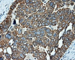 Serine racemase Antibody (OTI2E3), Novus Biologicals 0.1mL; Unlabeled:Antibodies,