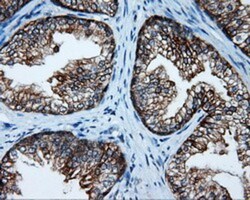 Serine racemase Antibody (OTI2E3), Novus Biologicals 0.1mL; Unlabeled:Antibodies,