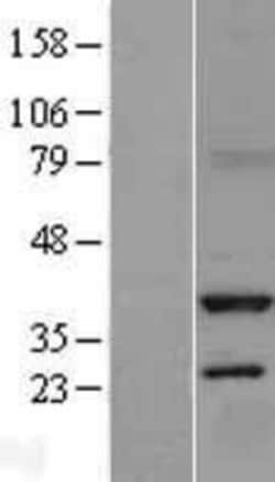 Novus Biologicals™ Serine racemase Overexpression Lysate
